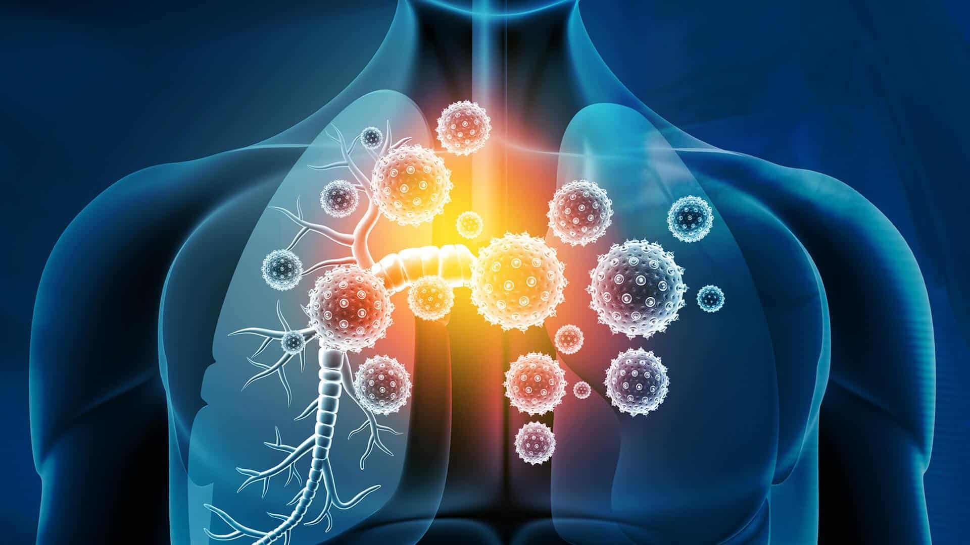 infection trigger your asthma
