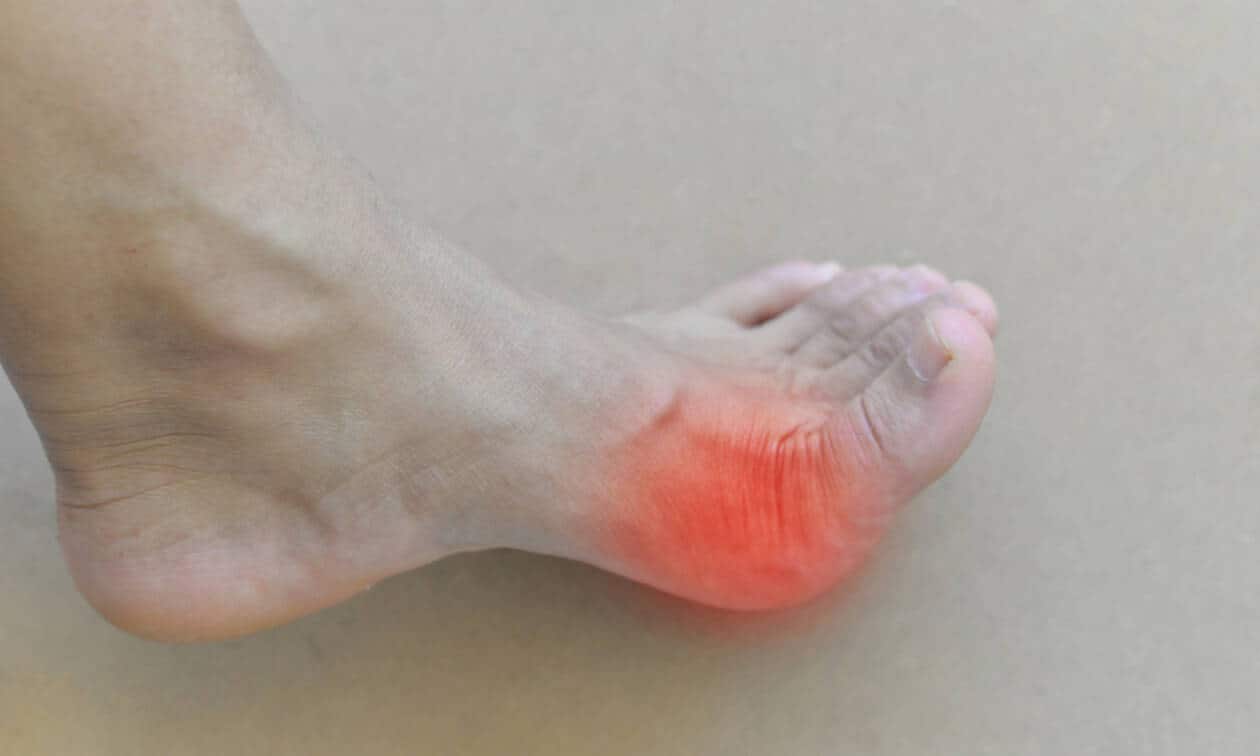what is gout symptoms